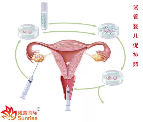 北京试管供卵_北京试管供卵：助力生育梦想