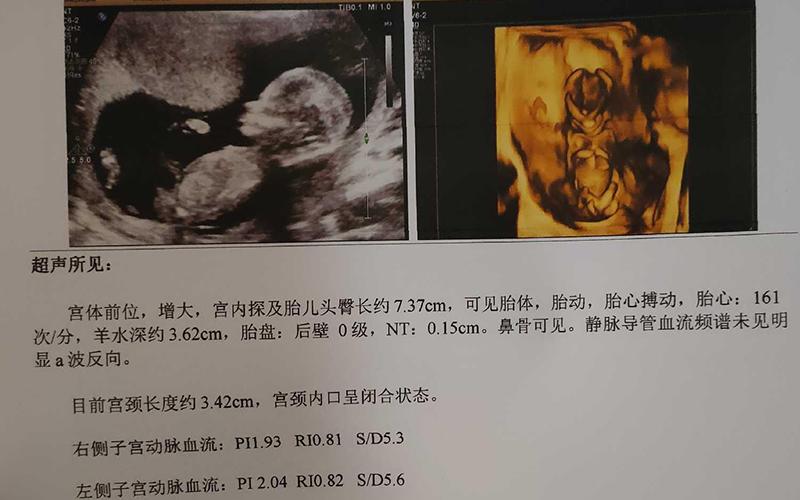 北京三代供卵试管双胞胎【北京三代供卵试管双胞胎:新生命的奇迹】