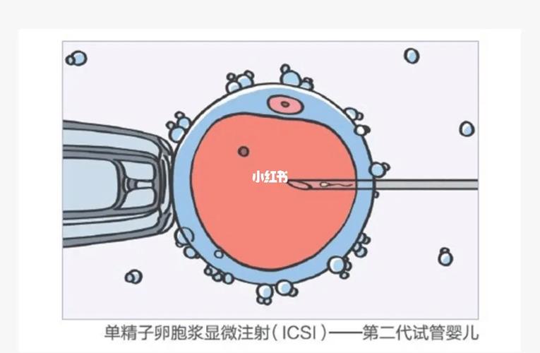 除了试管代怀还有办法吗【试管代怀外还有其他选择吗?】