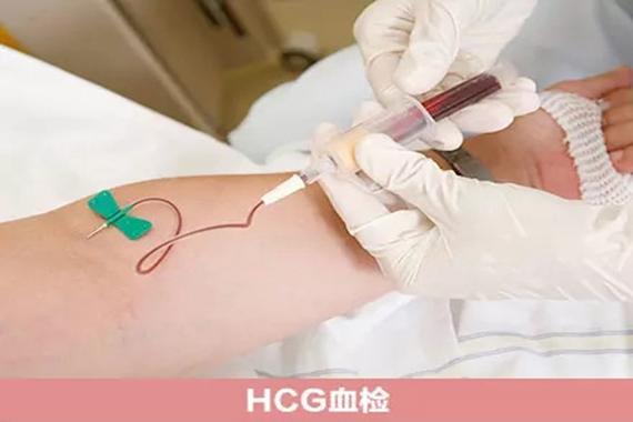 第三方供卵试管代怀_第三方供卵试管代怀：辅助生殖技术的新希望