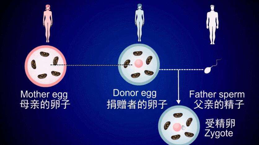 波士顿圆环试管代怀_波士顿圆环试管代怀:新生命的希望